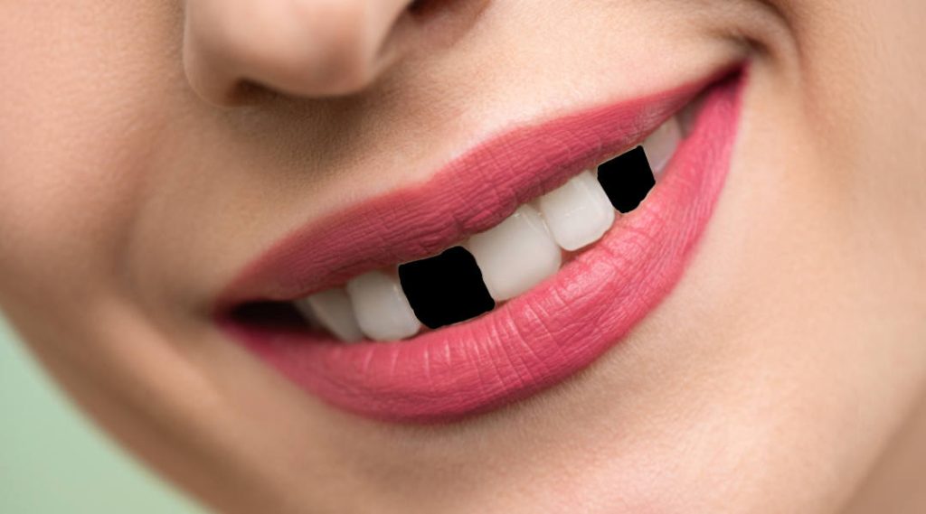 Que significa soñar que se te caen los dientes