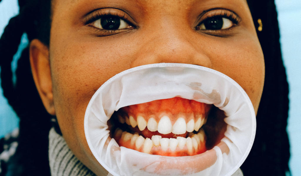 soñar que se te caen todos los dientes